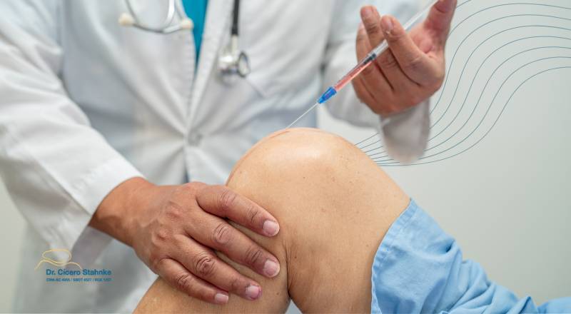 Suplementos ajudam mesmo o joelho? Entenda quando a infiltração é indicada, quais os tipos (corticoide, ácido hialurônico, PRP) e o que esperar do tratamento. Dr. Cícero Stahnke, ortopedista do joelho em Florianópolis.